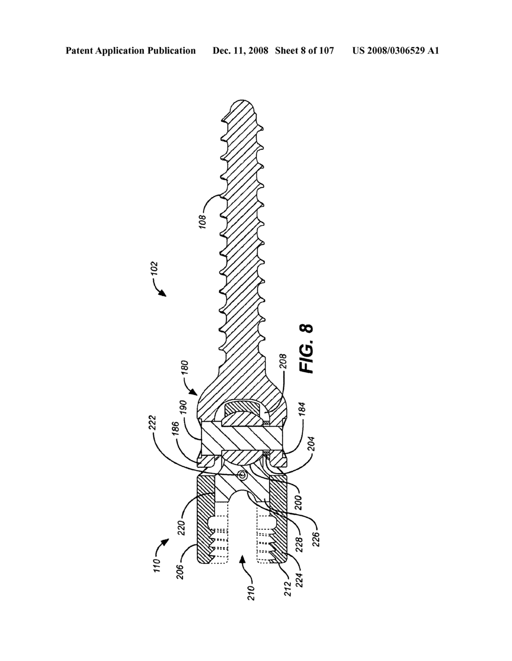 DEFLECTION ROD SYSTEM FOR A DYNAMIC STABILIZATION AND MOTION PRESERVATION SPINAL IMPLANTATION SYSTEM AND METHOD - diagram, schematic, and image 09