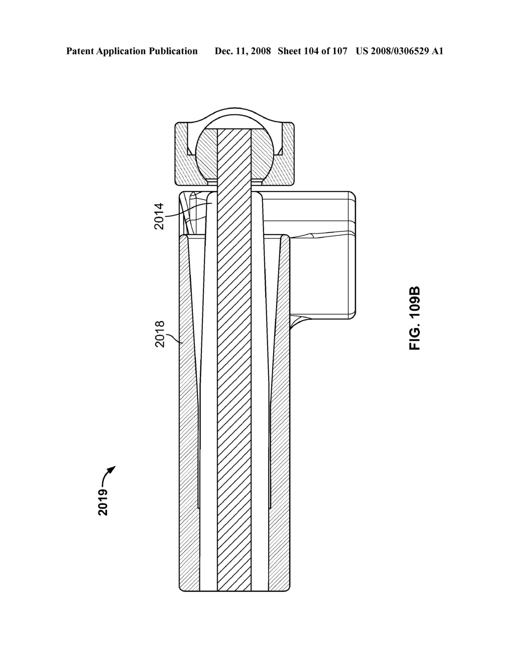 DEFLECTION ROD SYSTEM FOR A DYNAMIC STABILIZATION AND MOTION PRESERVATION SPINAL IMPLANTATION SYSTEM AND METHOD - diagram, schematic, and image 105