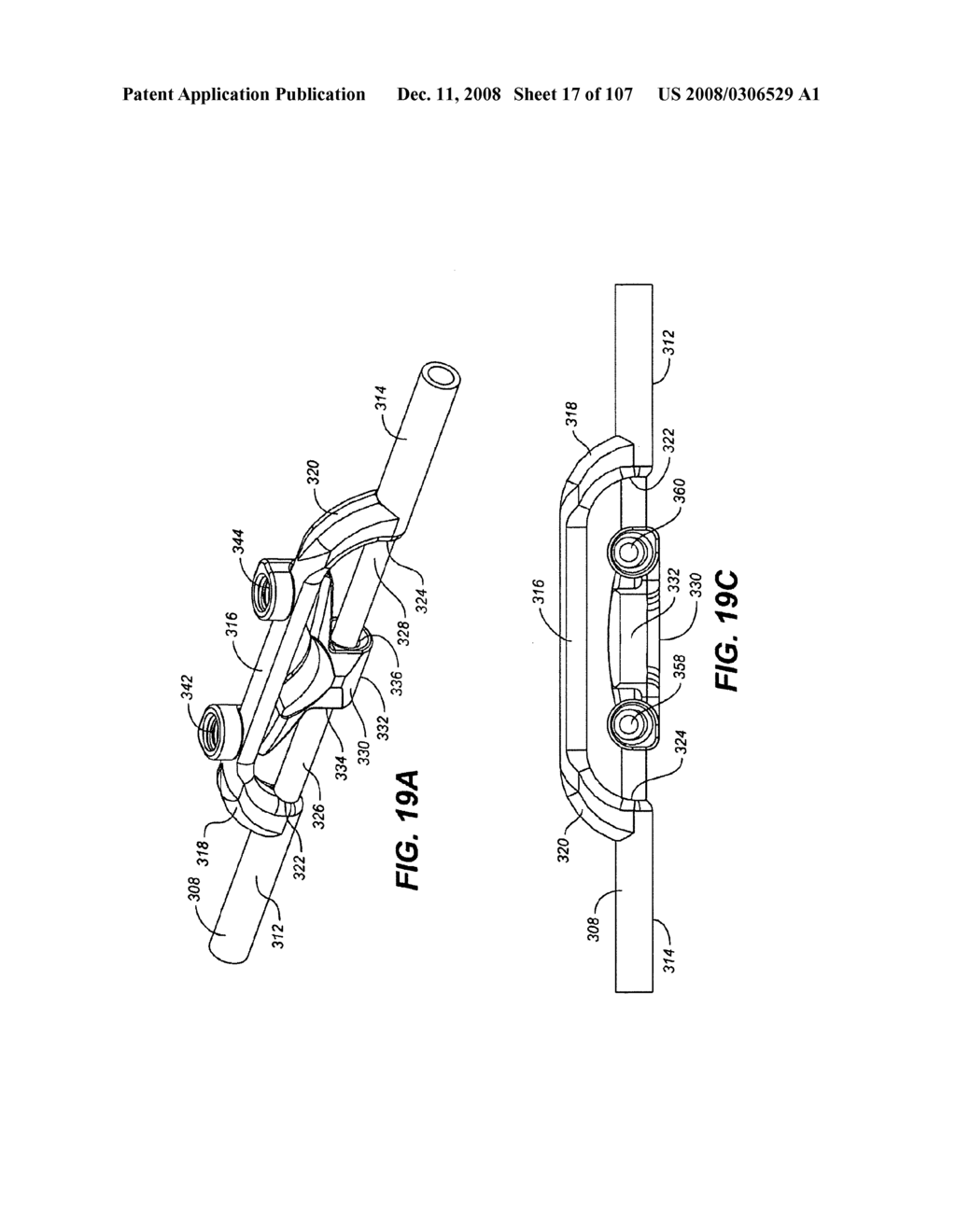 DEFLECTION ROD SYSTEM FOR A DYNAMIC STABILIZATION AND MOTION PRESERVATION SPINAL IMPLANTATION SYSTEM AND METHOD - diagram, schematic, and image 18