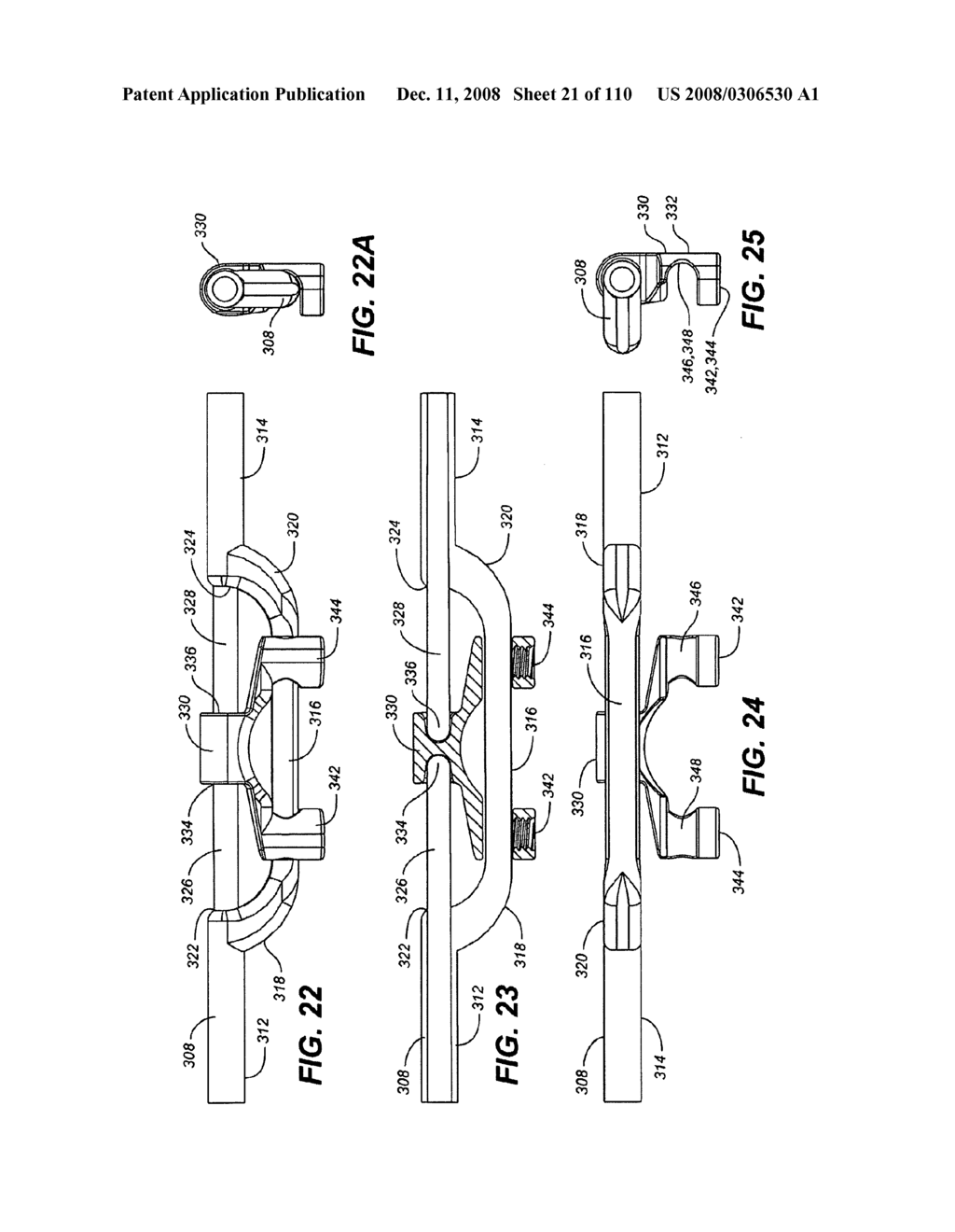 DEFLECTION ROD SYSTEM WITH MOUNT FOR A DYNAMIC STABILIZATION AND MOTION PRESERVATION SPINAL IMPLANTATION SYSTEM AND METHOD - diagram, schematic, and image 22