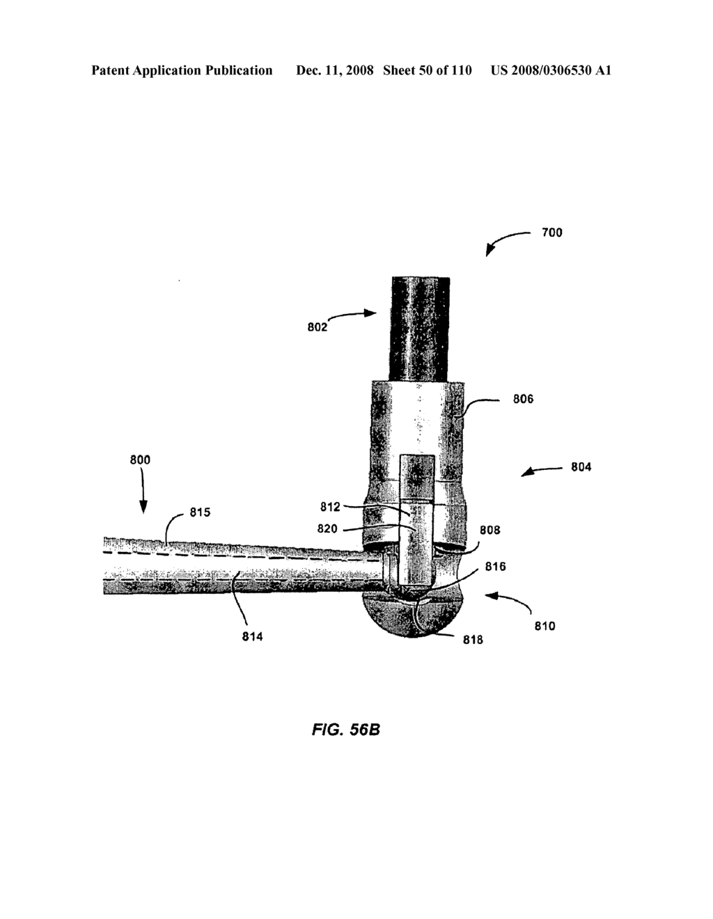 DEFLECTION ROD SYSTEM WITH MOUNT FOR A DYNAMIC STABILIZATION AND MOTION PRESERVATION SPINAL IMPLANTATION SYSTEM AND METHOD - diagram, schematic, and image 51