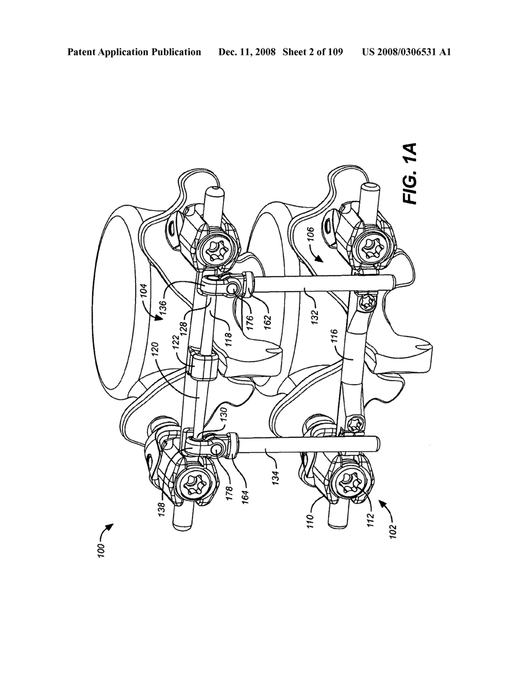  DEFLECTION ROD SYSTEM WITH A NON-LINEAR DEFLECTION TO LOAD CHARACTERISTIC FOR A DYNAMIC STABILIZATION AND MOTION PRESERVATION SPINAL IMPLANTATION SYSTEM AND METHOD - diagram, schematic, and image 03