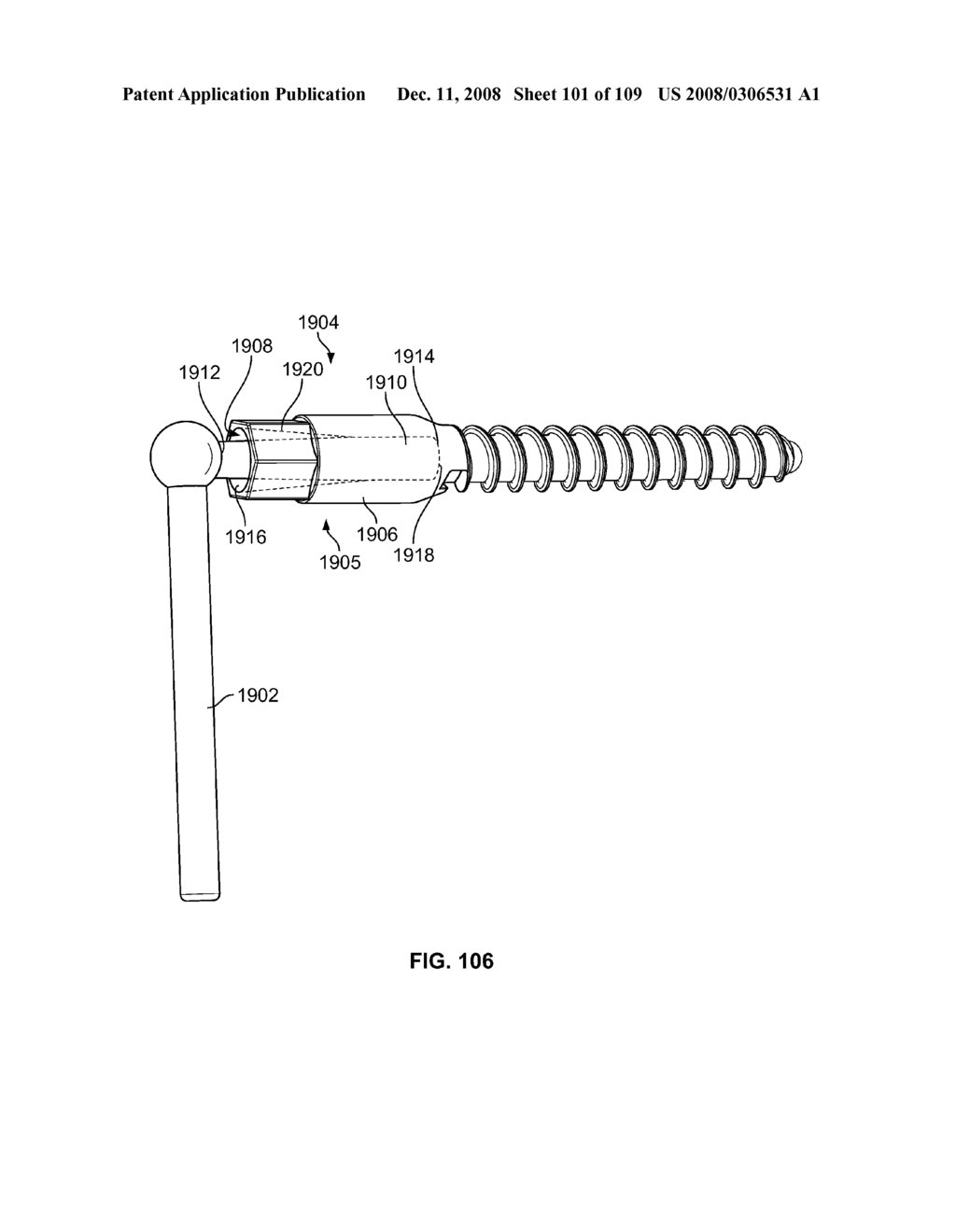  DEFLECTION ROD SYSTEM WITH A NON-LINEAR DEFLECTION TO LOAD CHARACTERISTIC FOR A DYNAMIC STABILIZATION AND MOTION PRESERVATION SPINAL IMPLANTATION SYSTEM AND METHOD - diagram, schematic, and image 102