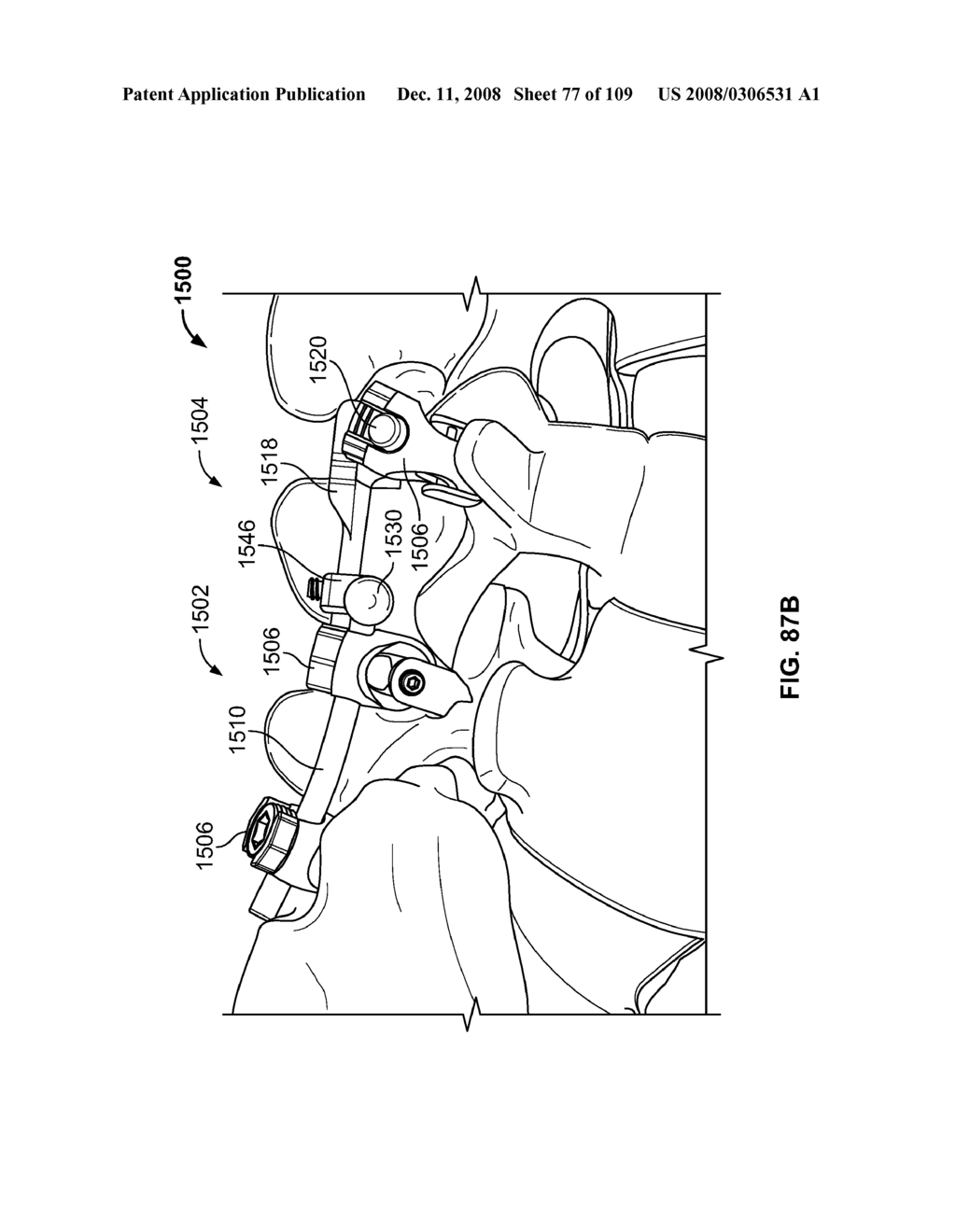  DEFLECTION ROD SYSTEM WITH A NON-LINEAR DEFLECTION TO LOAD CHARACTERISTIC FOR A DYNAMIC STABILIZATION AND MOTION PRESERVATION SPINAL IMPLANTATION SYSTEM AND METHOD - diagram, schematic, and image 78