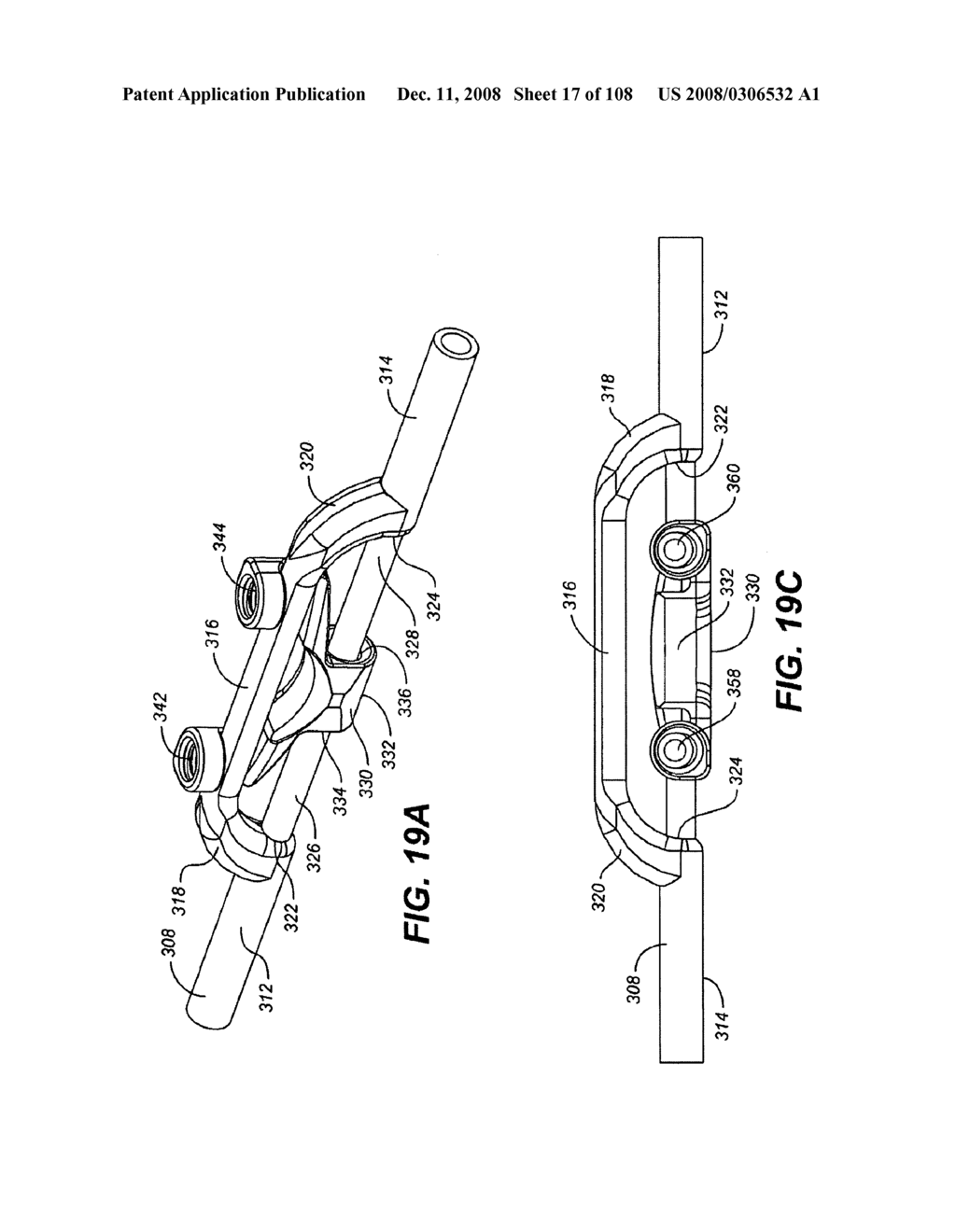 DEFLECTION ROD SYSTEM DIMENSIONED FOR DEFLECTION TO A LOAD CHARACTERISTIC FOR DYNAMIC STABILIZATION AND MOTION PRESERVATION SPINAL IMPLANTATION SYSTEM AND METHOD - diagram, schematic, and image 18