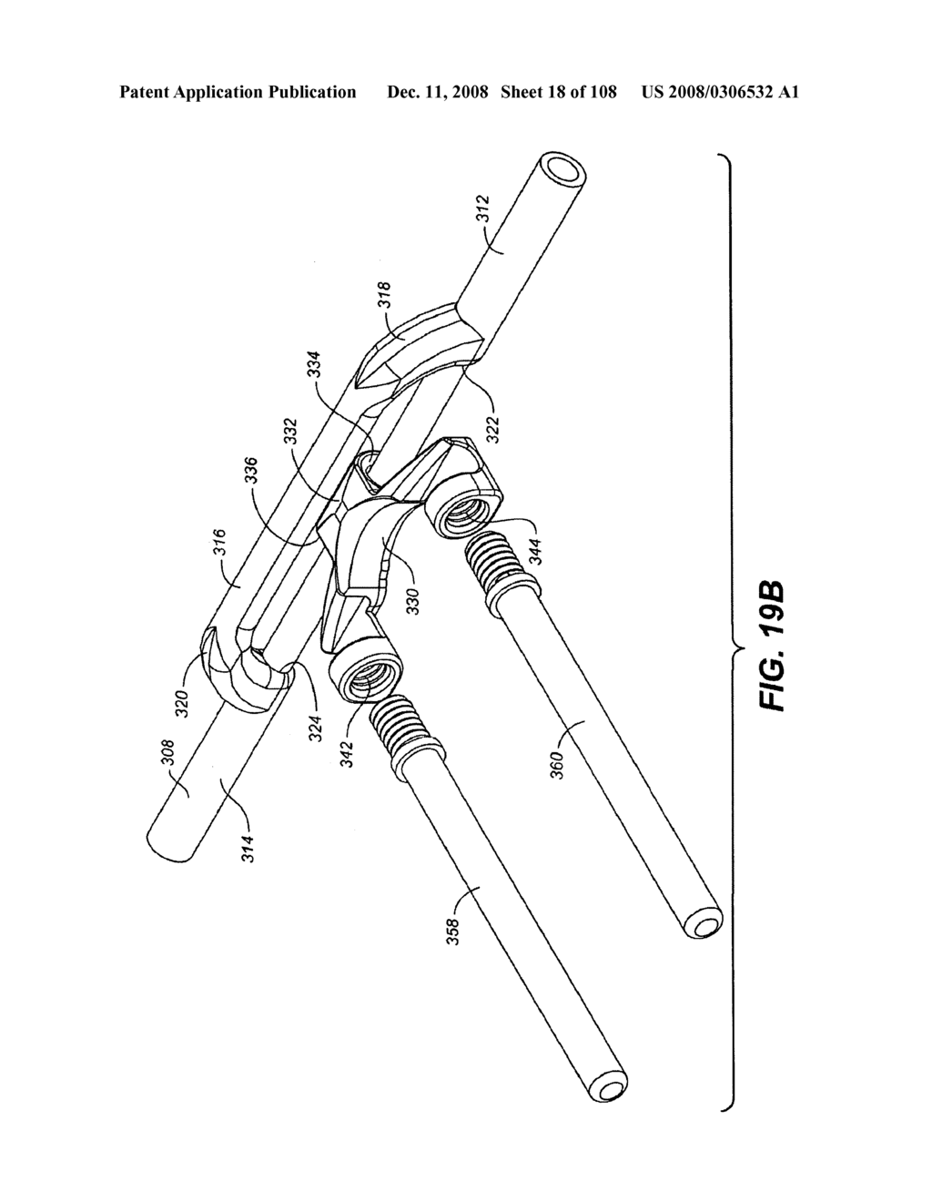 DEFLECTION ROD SYSTEM DIMENSIONED FOR DEFLECTION TO A LOAD CHARACTERISTIC FOR DYNAMIC STABILIZATION AND MOTION PRESERVATION SPINAL IMPLANTATION SYSTEM AND METHOD - diagram, schematic, and image 19