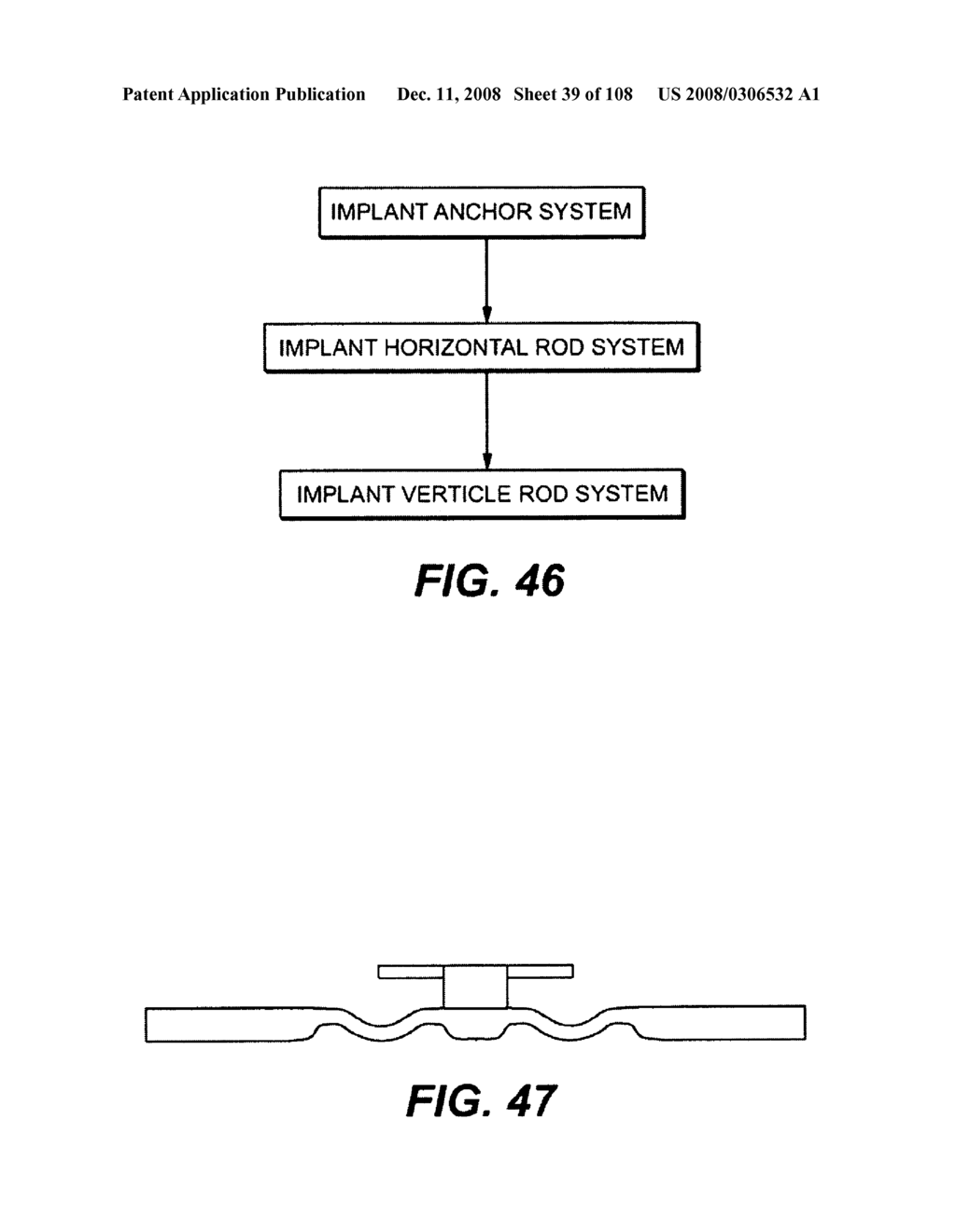 DEFLECTION ROD SYSTEM DIMENSIONED FOR DEFLECTION TO A LOAD CHARACTERISTIC FOR DYNAMIC STABILIZATION AND MOTION PRESERVATION SPINAL IMPLANTATION SYSTEM AND METHOD - diagram, schematic, and image 40