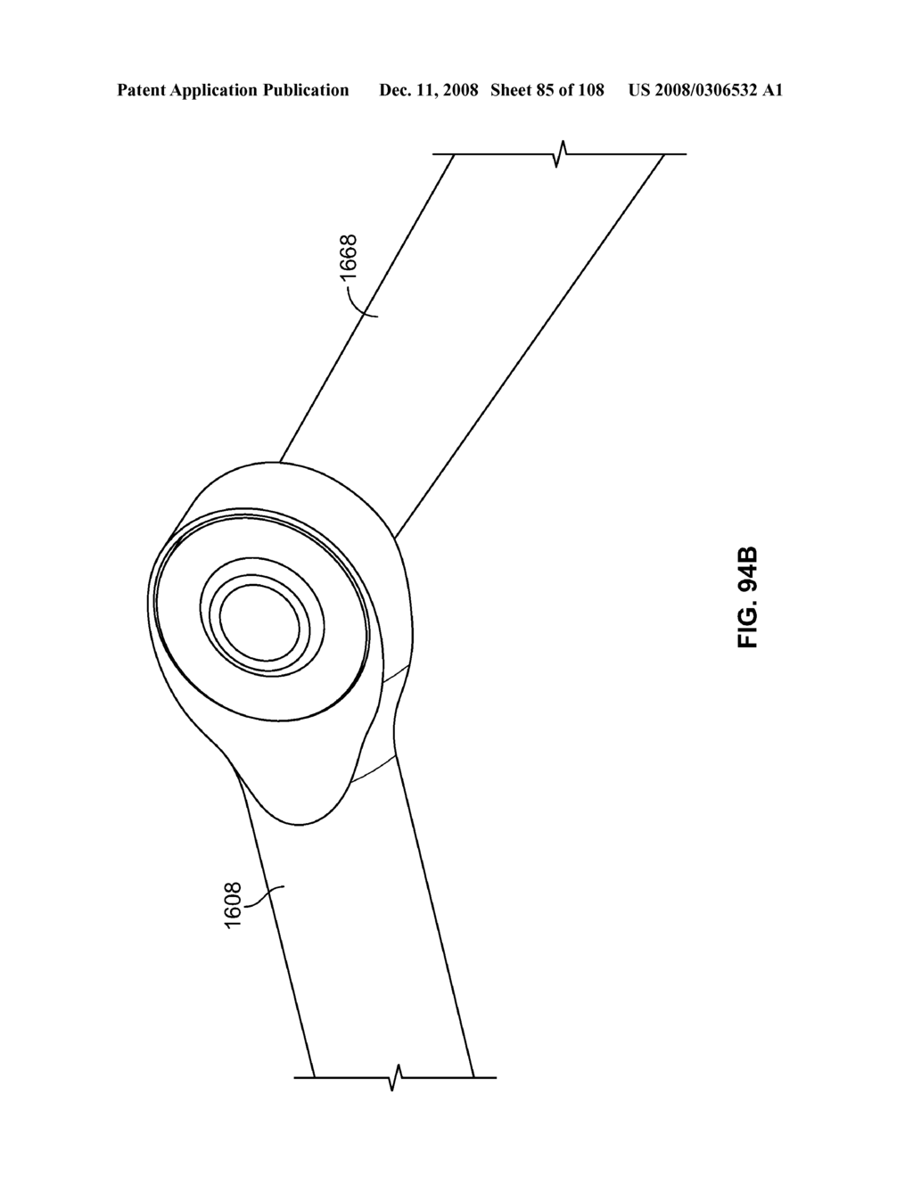 DEFLECTION ROD SYSTEM DIMENSIONED FOR DEFLECTION TO A LOAD CHARACTERISTIC FOR DYNAMIC STABILIZATION AND MOTION PRESERVATION SPINAL IMPLANTATION SYSTEM AND METHOD - diagram, schematic, and image 86