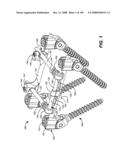 DEFLECTION ROD SYSTEM FOR USE WITH A VERTEBRAL FUSION IMPLANT FOR DYNAMIC STABILIZATION AND MOTION PRESERVATION SPINAL IMPLANTATION SYSTEM AND METHOD diagram and image