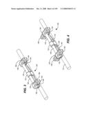 DEFLECTION ROD SYSTEM FOR USE WITH A VERTEBRAL FUSION IMPLANT FOR DYNAMIC STABILIZATION AND MOTION PRESERVATION SPINAL IMPLANTATION SYSTEM AND METHOD diagram and image