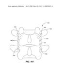 DEFLECTION ROD SYSTEM FOR USE WITH A VERTEBRAL FUSION IMPLANT FOR DYNAMIC STABILIZATION AND MOTION PRESERVATION SPINAL IMPLANTATION SYSTEM AND METHOD diagram and image