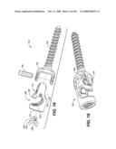 DEFLECTION ROD SYSTEM FOR USE WITH A VERTEBRAL FUSION IMPLANT FOR DYNAMIC STABILIZATION AND MOTION PRESERVATION SPINAL IMPLANTATION SYSTEM AND METHOD diagram and image