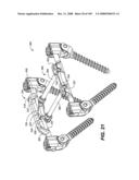 DEFLECTION ROD SYSTEM FOR USE WITH A VERTEBRAL FUSION IMPLANT FOR DYNAMIC STABILIZATION AND MOTION PRESERVATION SPINAL IMPLANTATION SYSTEM AND METHOD diagram and image