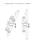 DEFLECTION ROD SYSTEM FOR USE WITH A VERTEBRAL FUSION IMPLANT FOR DYNAMIC STABILIZATION AND MOTION PRESERVATION SPINAL IMPLANTATION SYSTEM AND METHOD diagram and image