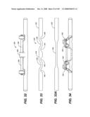 DEFLECTION ROD SYSTEM FOR USE WITH A VERTEBRAL FUSION IMPLANT FOR DYNAMIC STABILIZATION AND MOTION PRESERVATION SPINAL IMPLANTATION SYSTEM AND METHOD diagram and image