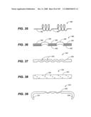 DEFLECTION ROD SYSTEM FOR USE WITH A VERTEBRAL FUSION IMPLANT FOR DYNAMIC STABILIZATION AND MOTION PRESERVATION SPINAL IMPLANTATION SYSTEM AND METHOD diagram and image