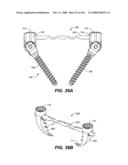 DEFLECTION ROD SYSTEM FOR USE WITH A VERTEBRAL FUSION IMPLANT FOR DYNAMIC STABILIZATION AND MOTION PRESERVATION SPINAL IMPLANTATION SYSTEM AND METHOD diagram and image