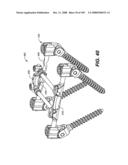 DEFLECTION ROD SYSTEM FOR USE WITH A VERTEBRAL FUSION IMPLANT FOR DYNAMIC STABILIZATION AND MOTION PRESERVATION SPINAL IMPLANTATION SYSTEM AND METHOD diagram and image