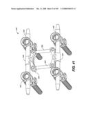 DEFLECTION ROD SYSTEM FOR USE WITH A VERTEBRAL FUSION IMPLANT FOR DYNAMIC STABILIZATION AND MOTION PRESERVATION SPINAL IMPLANTATION SYSTEM AND METHOD diagram and image