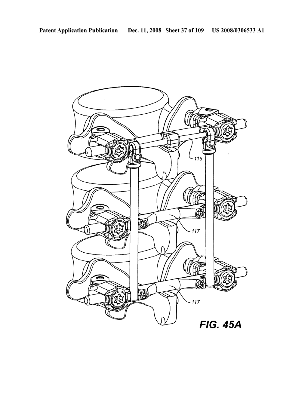 DEFLECTION ROD SYSTEM FOR USE WITH A VERTEBRAL FUSION IMPLANT FOR DYNAMIC STABILIZATION AND MOTION PRESERVATION SPINAL IMPLANTATION SYSTEM AND METHOD - diagram, schematic, and image 38