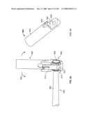 DEFLECTION ROD SYSTEM FOR USE WITH A VERTEBRAL FUSION IMPLANT FOR DYNAMIC STABILIZATION AND MOTION PRESERVATION SPINAL IMPLANTATION SYSTEM AND METHOD diagram and image