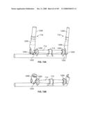 DEFLECTION ROD SYSTEM FOR USE WITH A VERTEBRAL FUSION IMPLANT FOR DYNAMIC STABILIZATION AND MOTION PRESERVATION SPINAL IMPLANTATION SYSTEM AND METHOD diagram and image