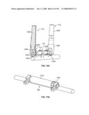 DEFLECTION ROD SYSTEM FOR USE WITH A VERTEBRAL FUSION IMPLANT FOR DYNAMIC STABILIZATION AND MOTION PRESERVATION SPINAL IMPLANTATION SYSTEM AND METHOD diagram and image