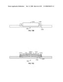 DEFLECTION ROD SYSTEM FOR USE WITH A VERTEBRAL FUSION IMPLANT FOR DYNAMIC STABILIZATION AND MOTION PRESERVATION SPINAL IMPLANTATION SYSTEM AND METHOD diagram and image