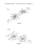 DEFLECTION ROD SYSTEM FOR USE WITH A VERTEBRAL FUSION IMPLANT FOR DYNAMIC STABILIZATION AND MOTION PRESERVATION SPINAL IMPLANTATION SYSTEM AND METHOD diagram and image