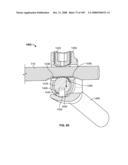 DEFLECTION ROD SYSTEM FOR USE WITH A VERTEBRAL FUSION IMPLANT FOR DYNAMIC STABILIZATION AND MOTION PRESERVATION SPINAL IMPLANTATION SYSTEM AND METHOD diagram and image