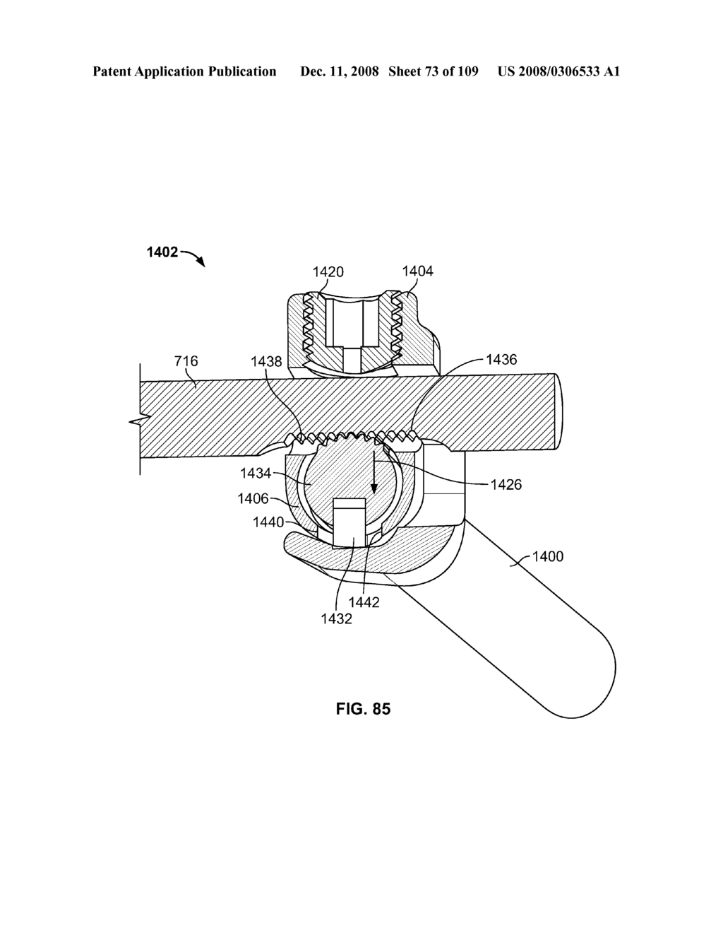 DEFLECTION ROD SYSTEM FOR USE WITH A VERTEBRAL FUSION IMPLANT FOR DYNAMIC STABILIZATION AND MOTION PRESERVATION SPINAL IMPLANTATION SYSTEM AND METHOD - diagram, schematic, and image 74