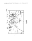 DEFLECTION ROD SYSTEM FOR USE WITH A VERTEBRAL FUSION IMPLANT FOR DYNAMIC STABILIZATION AND MOTION PRESERVATION SPINAL IMPLANTATION SYSTEM AND METHOD diagram and image