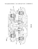 DEFLECTION ROD SYSTEM FOR USE WITH A VERTEBRAL FUSION IMPLANT FOR DYNAMIC STABILIZATION AND MOTION PRESERVATION SPINAL IMPLANTATION SYSTEM AND METHOD diagram and image