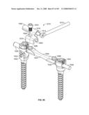 DEFLECTION ROD SYSTEM FOR USE WITH A VERTEBRAL FUSION IMPLANT FOR DYNAMIC STABILIZATION AND MOTION PRESERVATION SPINAL IMPLANTATION SYSTEM AND METHOD diagram and image