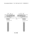 DEFLECTION ROD SYSTEM FOR USE WITH A VERTEBRAL FUSION IMPLANT FOR DYNAMIC STABILIZATION AND MOTION PRESERVATION SPINAL IMPLANTATION SYSTEM AND METHOD diagram and image