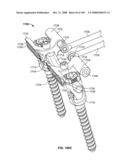 DEFLECTION ROD SYSTEM FOR USE WITH A VERTEBRAL FUSION IMPLANT FOR DYNAMIC STABILIZATION AND MOTION PRESERVATION SPINAL IMPLANTATION SYSTEM AND METHOD diagram and image