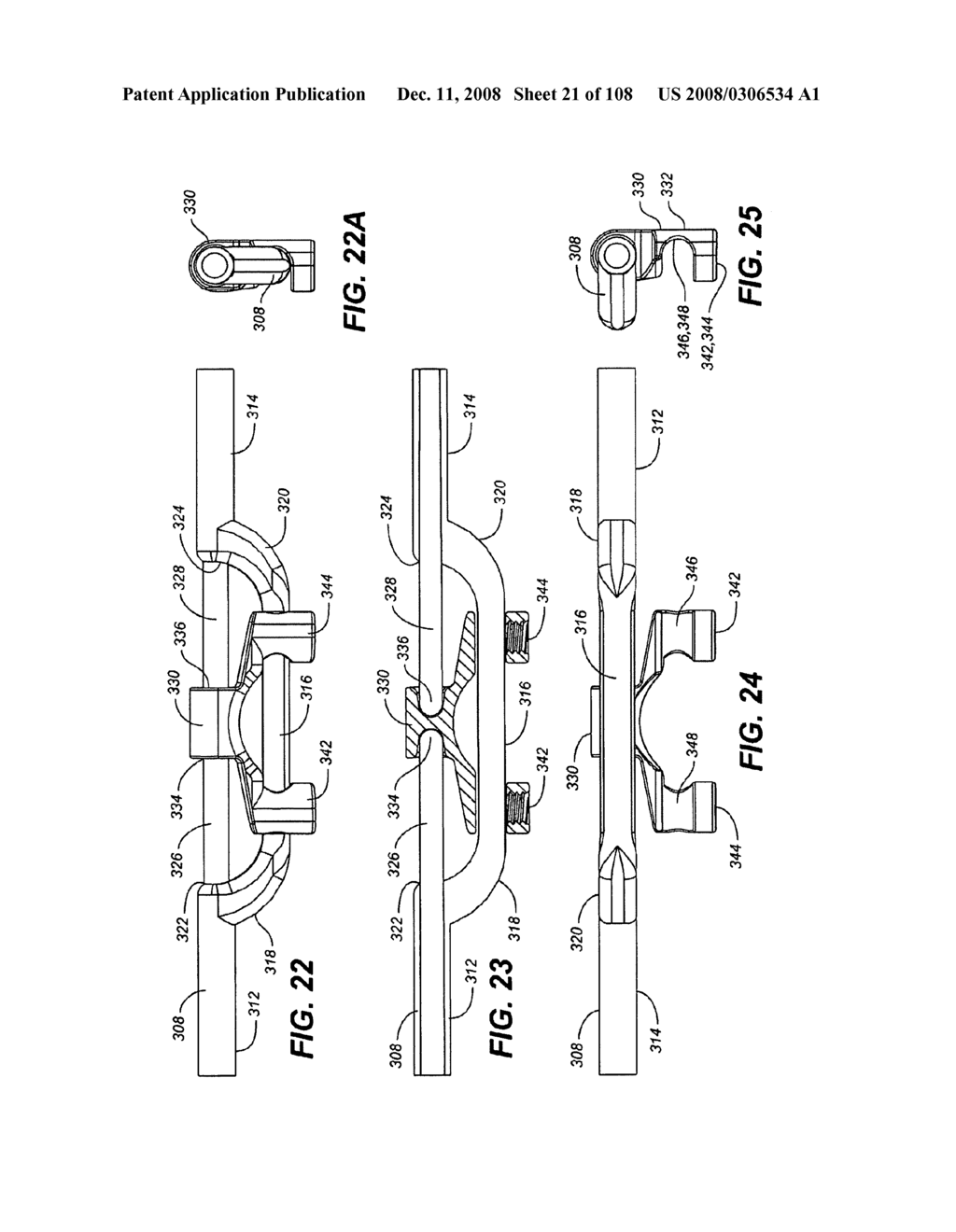 DUAL DEFLECTION ROD SYSTEM FOR A DYNAMIC STABILIZATION AND MOTION PRESERVATION SPINAL IMPLANTATION SYSTEM AND METHOD - diagram, schematic, and image 22