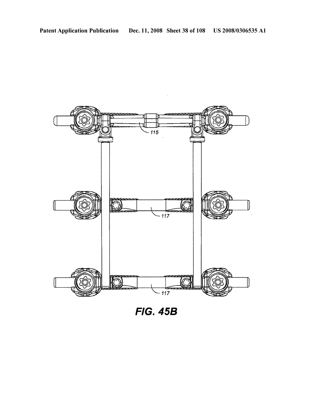 METHOD FOR IMPLANTING A DEFLECTION ROD SYSTEM AND CUSTOMIZING THE DEFLECTION ROD SYSTEM FOR A PARTICULAR PATIENT NEED FOR DYNAMIC STABILIZATION AND MOTION PRESERVATION SPINAL IMPLANTATION SYSTEM - diagram, schematic, and image 39