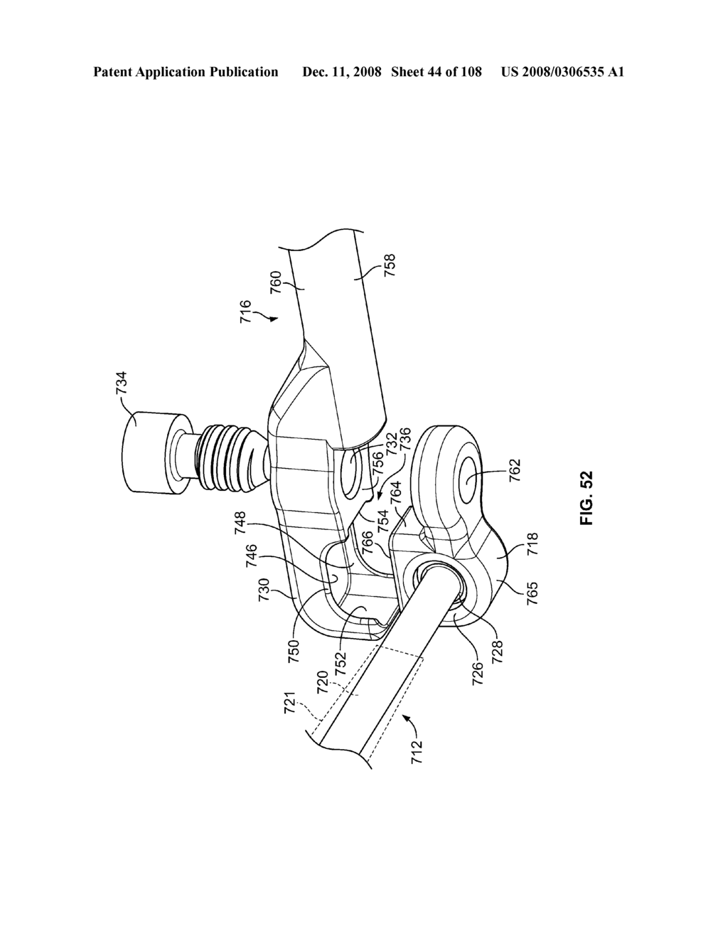 METHOD FOR IMPLANTING A DEFLECTION ROD SYSTEM AND CUSTOMIZING THE DEFLECTION ROD SYSTEM FOR A PARTICULAR PATIENT NEED FOR DYNAMIC STABILIZATION AND MOTION PRESERVATION SPINAL IMPLANTATION SYSTEM - diagram, schematic, and image 45