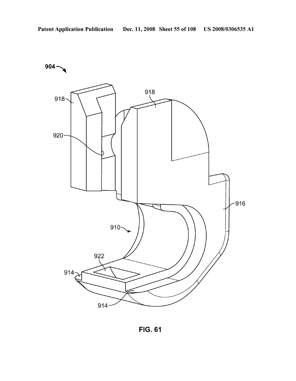 METHOD FOR IMPLANTING A DEFLECTION ROD SYSTEM AND CUSTOMIZING THE DEFLECTION ROD SYSTEM FOR A PARTICULAR PATIENT NEED FOR DYNAMIC STABILIZATION AND MOTION PRESERVATION SPINAL IMPLANTATION SYSTEM - diagram, schematic, and image 56