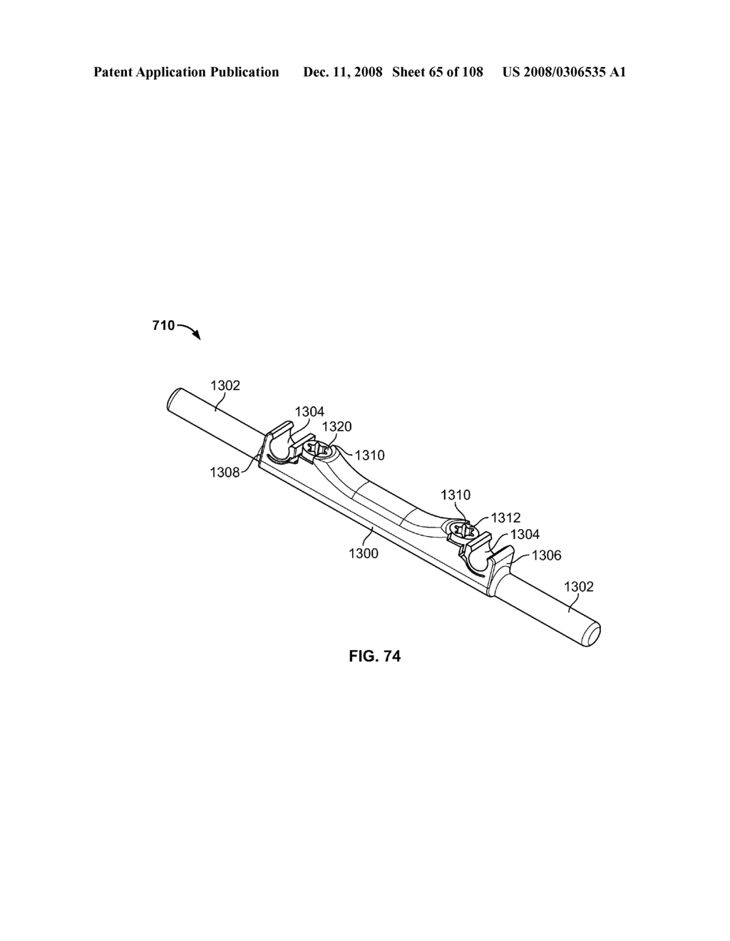 METHOD FOR IMPLANTING A DEFLECTION ROD SYSTEM AND CUSTOMIZING THE DEFLECTION ROD SYSTEM FOR A PARTICULAR PATIENT NEED FOR DYNAMIC STABILIZATION AND MOTION PRESERVATION SPINAL IMPLANTATION SYSTEM - diagram, schematic, and image 66