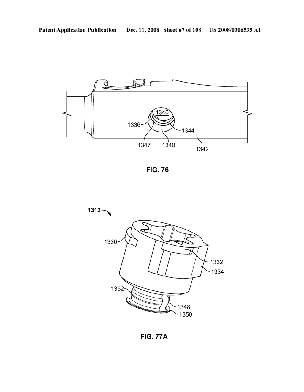 METHOD FOR IMPLANTING A DEFLECTION ROD SYSTEM AND CUSTOMIZING THE DEFLECTION ROD SYSTEM FOR A PARTICULAR PATIENT NEED FOR DYNAMIC STABILIZATION AND MOTION PRESERVATION SPINAL IMPLANTATION SYSTEM - diagram, schematic, and image 68