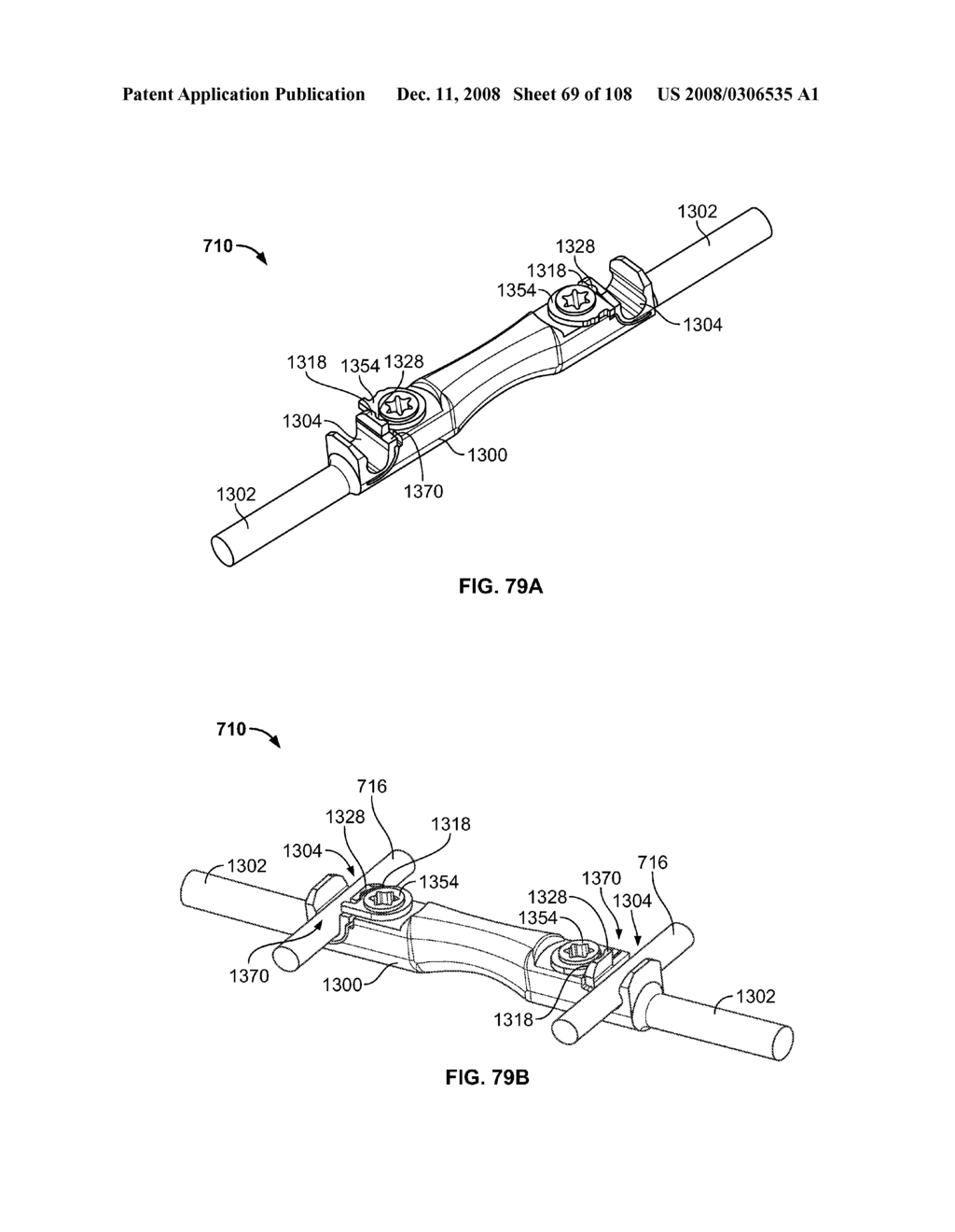 METHOD FOR IMPLANTING A DEFLECTION ROD SYSTEM AND CUSTOMIZING THE DEFLECTION ROD SYSTEM FOR A PARTICULAR PATIENT NEED FOR DYNAMIC STABILIZATION AND MOTION PRESERVATION SPINAL IMPLANTATION SYSTEM - diagram, schematic, and image 70