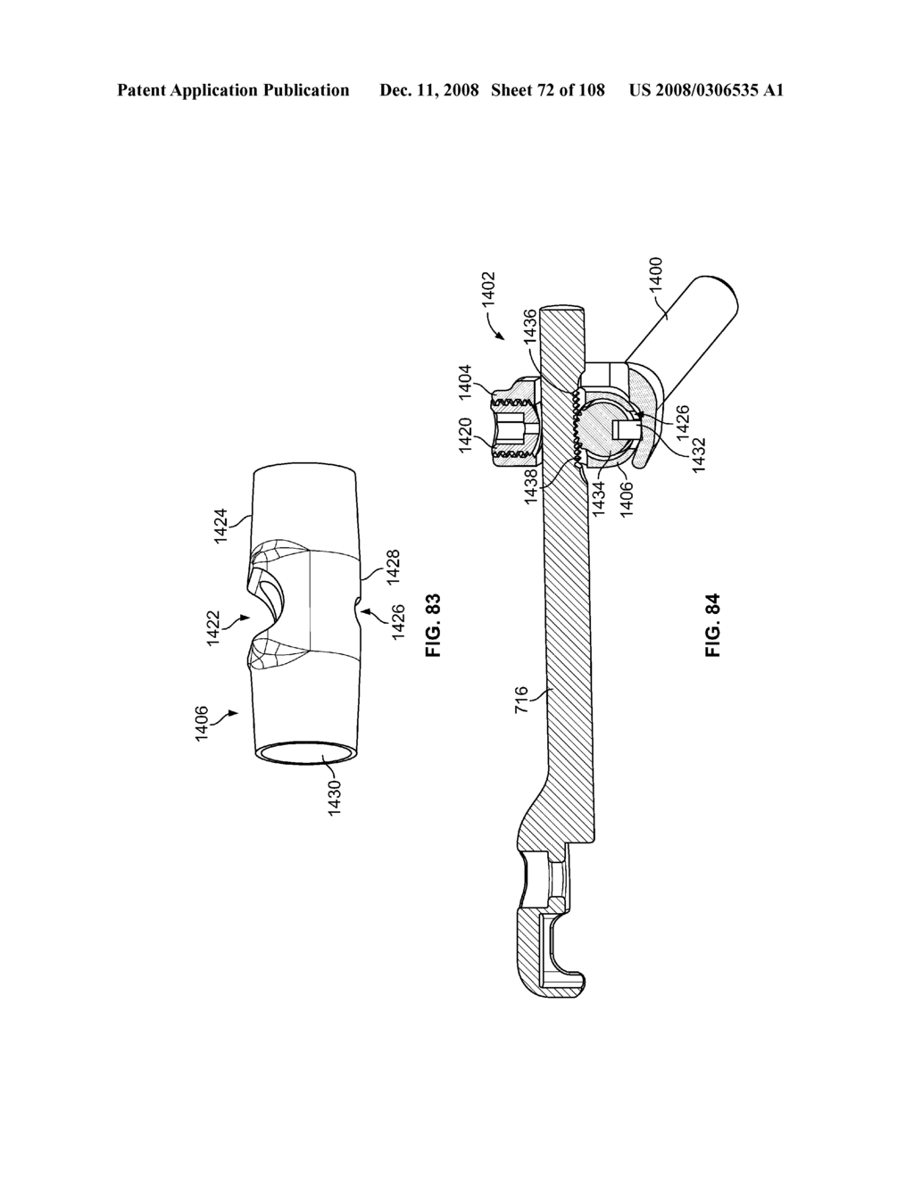 METHOD FOR IMPLANTING A DEFLECTION ROD SYSTEM AND CUSTOMIZING THE DEFLECTION ROD SYSTEM FOR A PARTICULAR PATIENT NEED FOR DYNAMIC STABILIZATION AND MOTION PRESERVATION SPINAL IMPLANTATION SYSTEM - diagram, schematic, and image 73