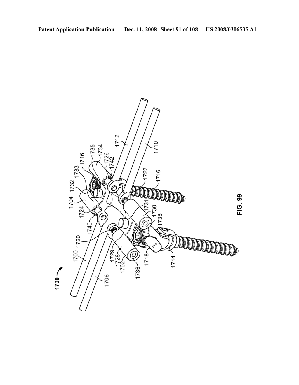 METHOD FOR IMPLANTING A DEFLECTION ROD SYSTEM AND CUSTOMIZING THE DEFLECTION ROD SYSTEM FOR A PARTICULAR PATIENT NEED FOR DYNAMIC STABILIZATION AND MOTION PRESERVATION SPINAL IMPLANTATION SYSTEM - diagram, schematic, and image 92