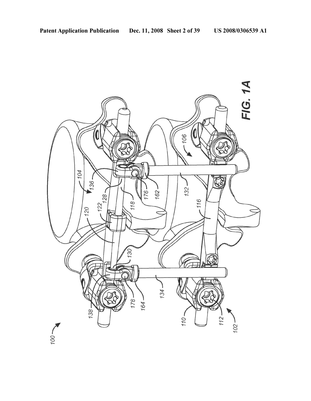 DYNAMIC STABILIZATION AND MOTION PRESERVATION SPINAL IMPLANTATION SYSTEM AND METHOD WITH A DEFLECTION ROD - diagram, schematic, and image 03