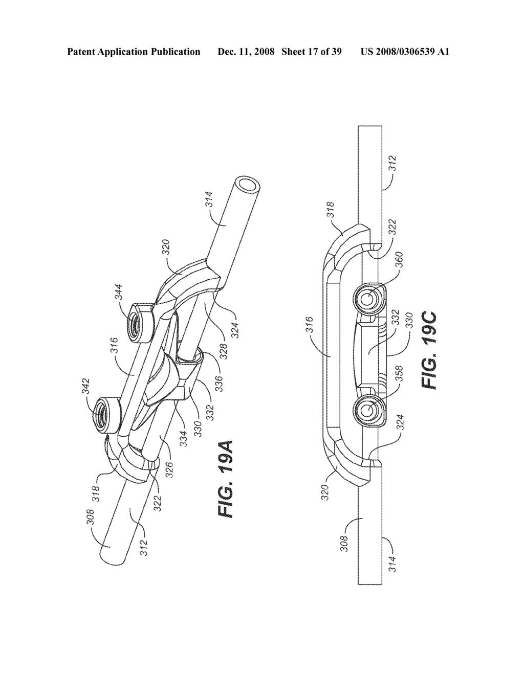 DYNAMIC STABILIZATION AND MOTION PRESERVATION SPINAL IMPLANTATION SYSTEM AND METHOD WITH A DEFLECTION ROD - diagram, schematic, and image 18