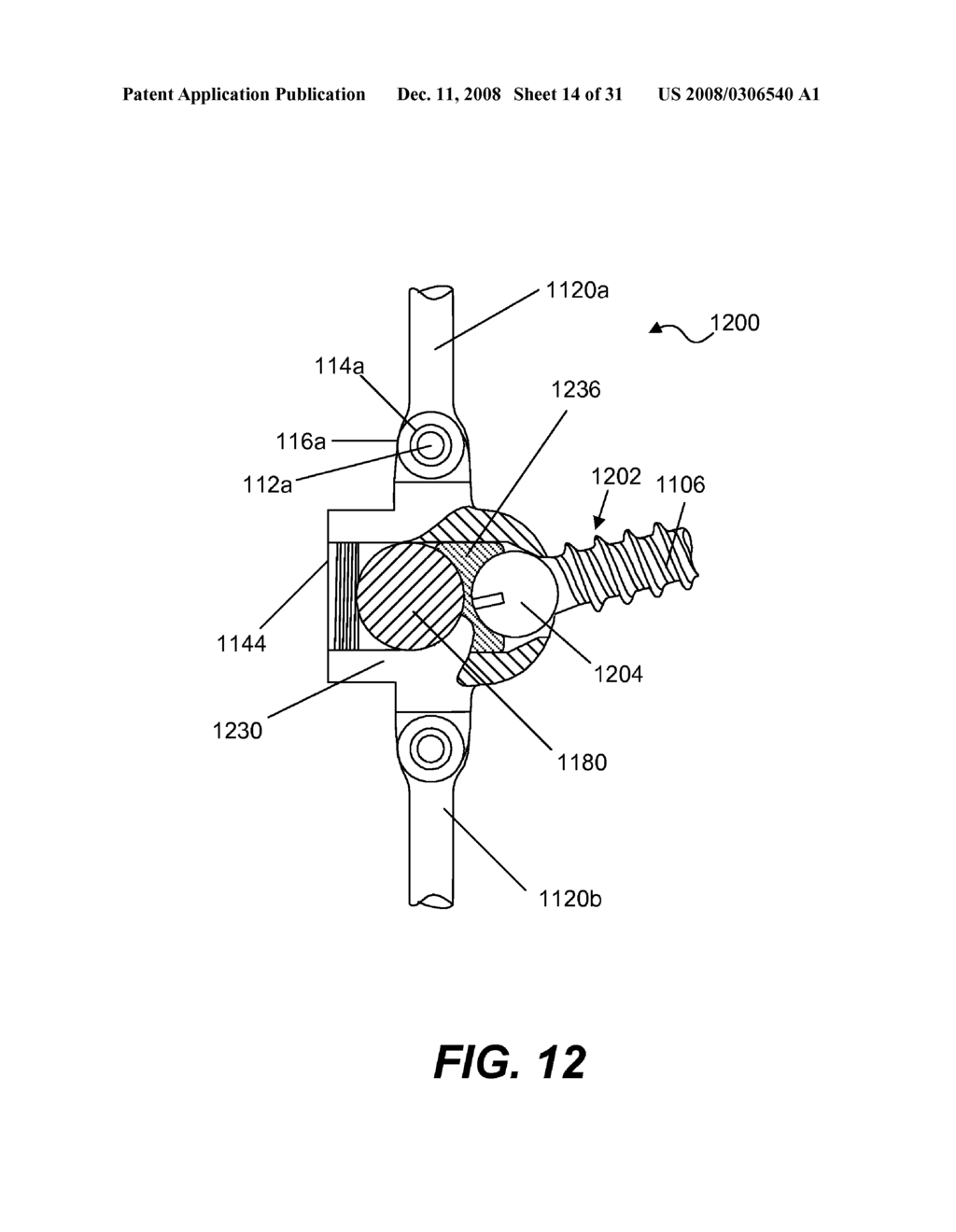 SPINE IMPLANT WITH A DEFELCTION ROD SYSTEM ANCHORED TO A BONE ANCHOR AND METHOD - diagram, schematic, and image 15