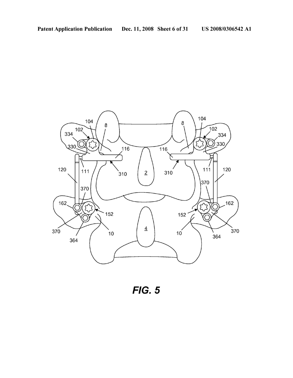 SPINE IMPLANT WITH A DEFLECTION ROD SYSTEM AND CONNECTING LINKAGES AND METHOD - diagram, schematic, and image 07