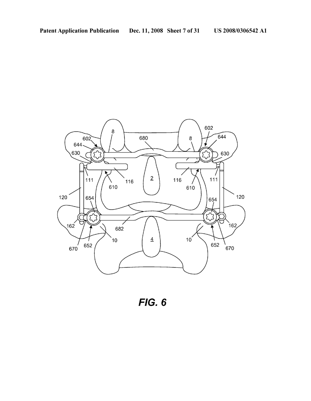 SPINE IMPLANT WITH A DEFLECTION ROD SYSTEM AND CONNECTING LINKAGES AND METHOD - diagram, schematic, and image 08